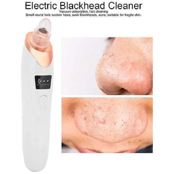 Cell Operated Black Head Remover 300 10